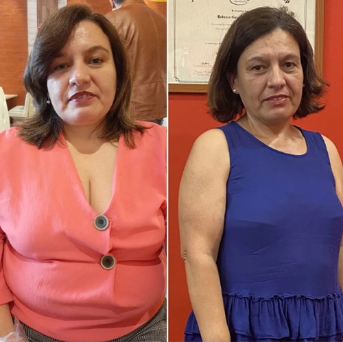 Donna prima e dopo trattamento con spirulina, miglioramento visibile.