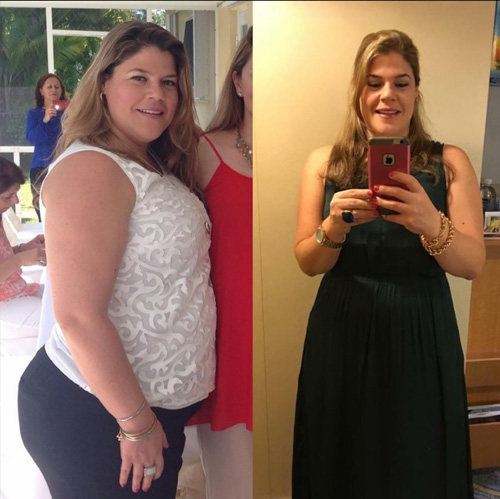 Donna prima e dopo la perdita di peso con la dieta a base di spirulina.